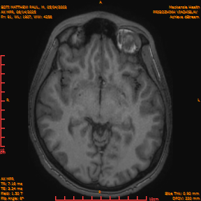 2025-06-14/AX MPR/0092-IM697.png