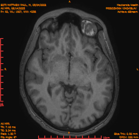 2025-06-14/AX MPR/0093-IM698.png