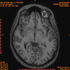 2025-06-14/AX MPR/0094-IM699.png