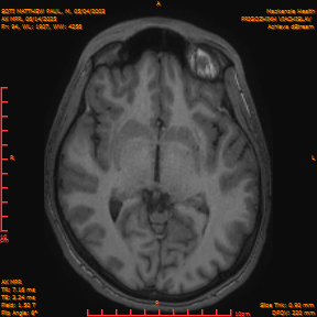 2025-06-14/AX MPR/0095-IM700.png