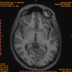 2025-06-14/AX MPR/0096-IM701.png