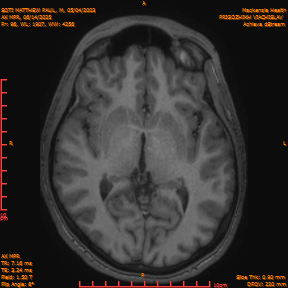 2025-06-14/AX MPR/0097-IM702.png