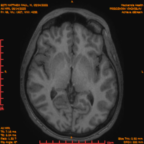 2025-06-14/AX MPR/0099-IM704.png