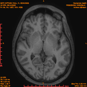 2025-06-14/AX MPR/0100-IM705.png