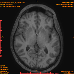 2025-06-14/AX MPR/0101-IM706.png