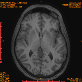 2025-06-14/AX MPR/0102-IM707.png