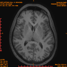2025-06-14/AX MPR/0105-IM710.png