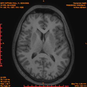 2025-06-14/AX MPR/0107-IM712.png