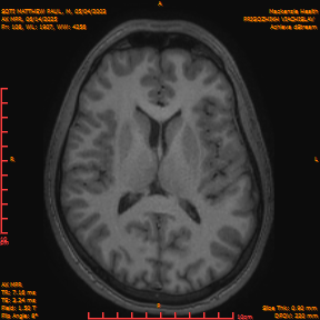 2025-06-14/AX MPR/0109-IM714.png