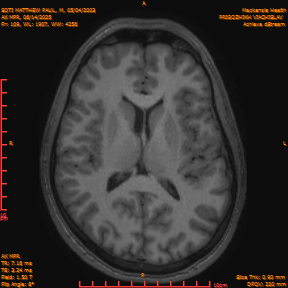 2025-06-14/AX MPR/0110-IM715.png