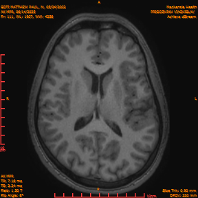 2025-06-14/AX MPR/0112-IM717.png