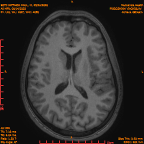 2025-06-14/AX MPR/0114-IM719.png