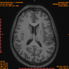 2025-06-14/AX MPR/0115-IM720.png