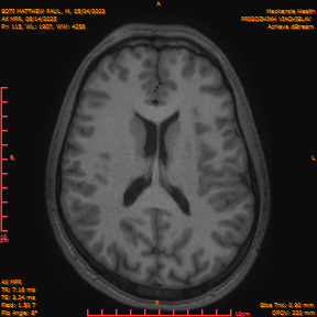 2025-06-14/AX MPR/0116-IM721.png