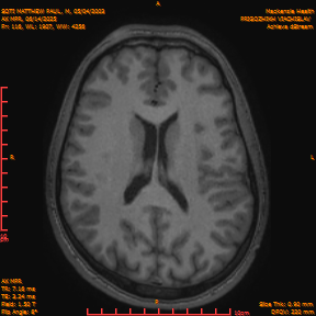 2025-06-14/AX MPR/0117-IM722.png