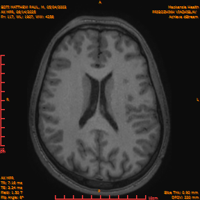 2025-06-14/AX MPR/0118-IM723.png