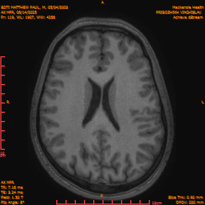 2025-06-14/AX MPR/0120-IM725.png
