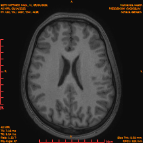 2025-06-14/AX MPR/0121-IM726.png