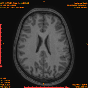 2025-06-14/AX MPR/0122-IM727.png