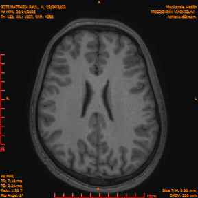 2025-06-14/AX MPR/0123-IM728.png
