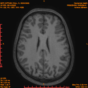 2025-06-14/AX MPR/0124-IM729.png