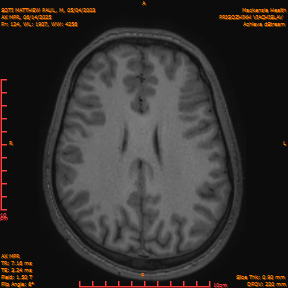 2025-06-14/AX MPR/0125-IM730.png