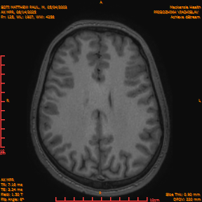 2025-06-14/AX MPR/0126-IM731.png