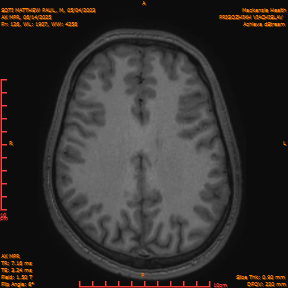 2025-06-14/AX MPR/0127-IM732.png