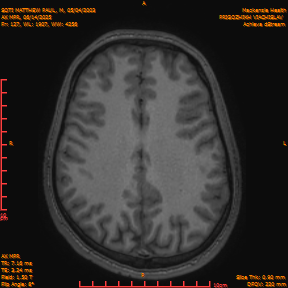 2025-06-14/AX MPR/0128-IM733.png