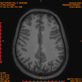 2025-06-14/AX MPR/0130-IM735.png