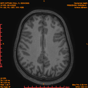 2025-06-14/AX MPR/0131-IM736.png