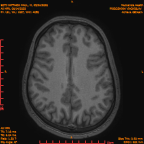 2025-06-14/AX MPR/0132-IM737.png