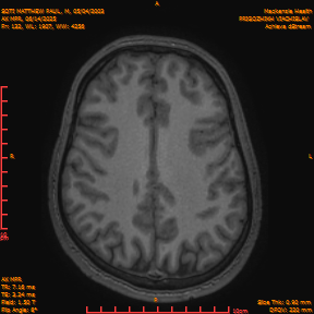 2025-06-14/AX MPR/0133-IM738.png