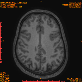 2025-06-14/AX MPR/0134-IM739.png