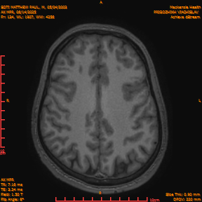 2025-06-14/AX MPR/0135-IM740.png