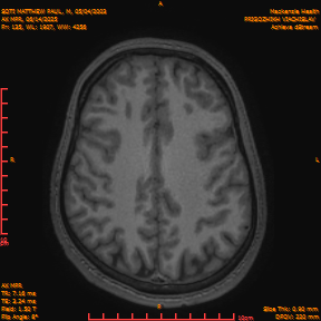 2025-06-14/AX MPR/0136-IM741.png