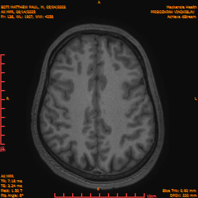 2025-06-14/AX MPR/0137-IM742.png