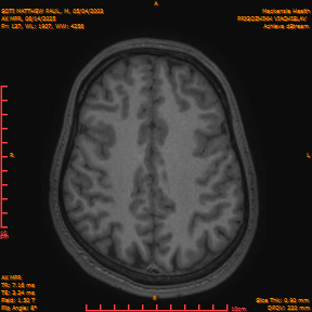 2025-06-14/AX MPR/0138-IM743.png