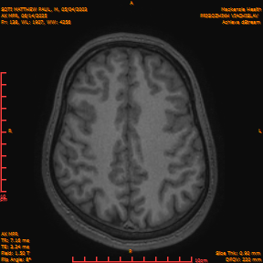 2025-06-14/AX MPR/0139-IM744.png