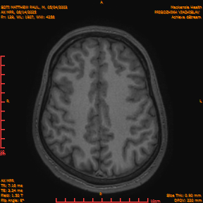 2025-06-14/AX MPR/0140-IM745.png
