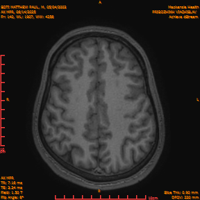 2025-06-14/AX MPR/0141-IM746.png