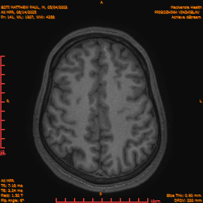 2025-06-14/AX MPR/0142-IM747.png