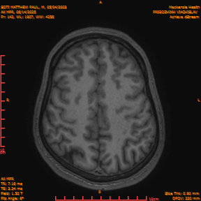 2025-06-14/AX MPR/0143-IM748.png