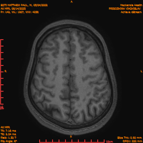 2025-06-14/AX MPR/0144-IM749.png