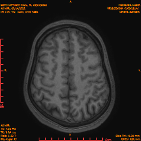 2025-06-14/AX MPR/0145-IM750.png