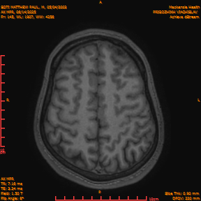 2025-06-14/AX MPR/0146-IM751.png