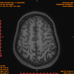 2025-06-14/AX MPR/0149-IM754.png