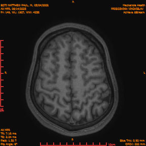 2025-06-14/AX MPR/0150-IM755.png