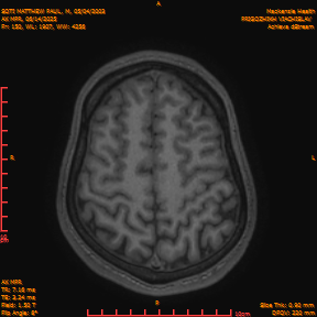 2025-06-14/AX MPR/0151-IM756.png