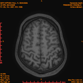 2025-06-14/AX MPR/0152-IM757.png
